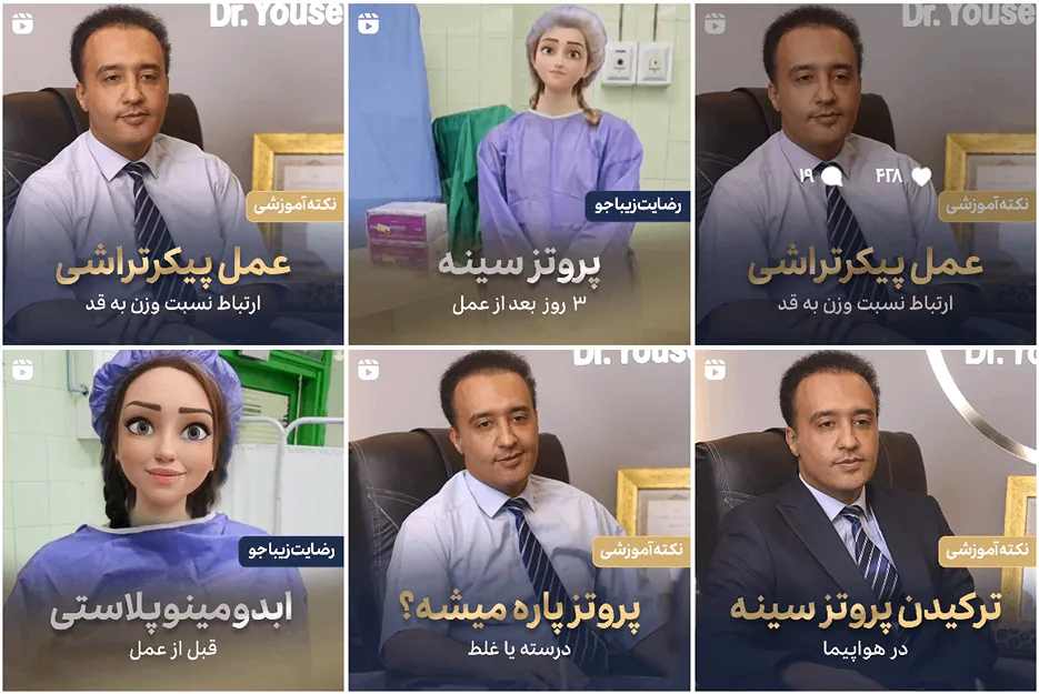 پیکرتراشی در مشهد توسط دکتر یوسفی کاملا قابل انجام است