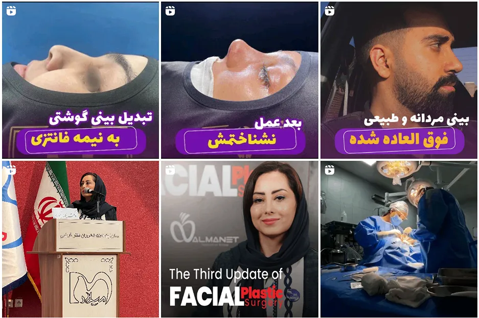 عمل لیپوماتیک در مشهد توسط دکتر تیموری کاملا قابل انجام است