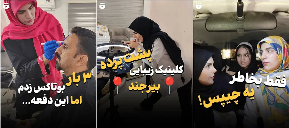 نمونه کار یکی از بهترین دکتر بوتاکس بیرجند را مشاهده میفرمایید.