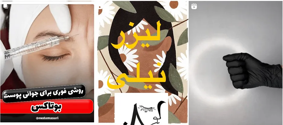 بوتاکس در بیرجند در کلینیک دکتر کمالی کاملا قابل انجام است