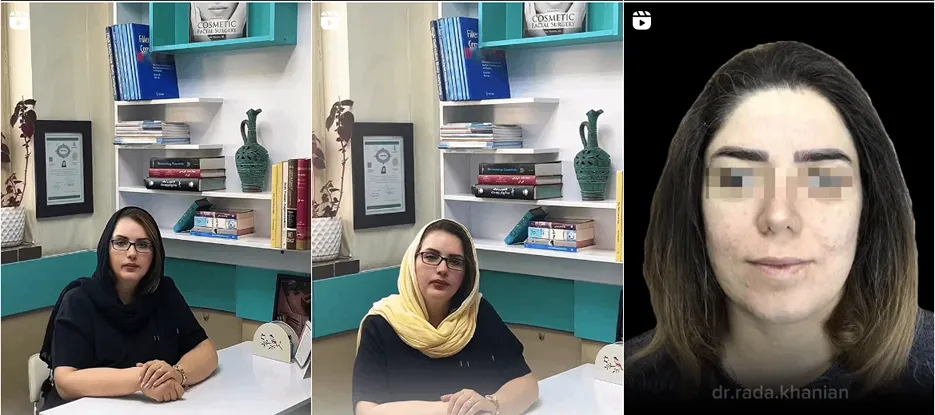 بوتاکس در کرمانشاه توسط دکتر خانیان کاملا قابل انجام است