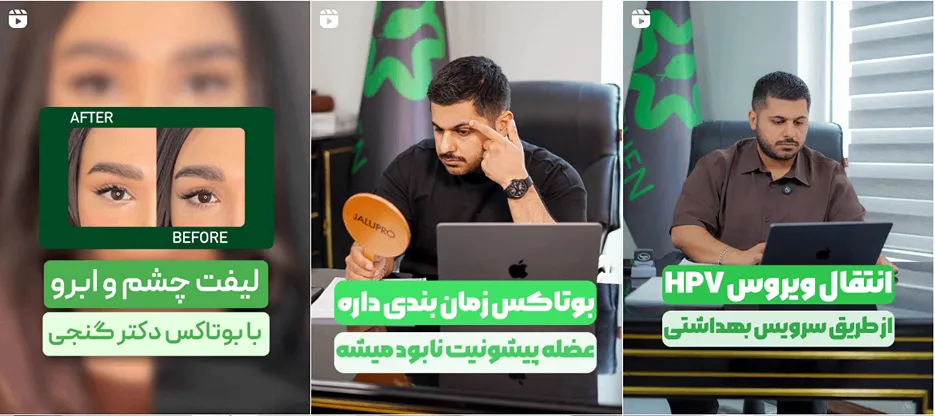 نمونه کار یکی از بهترین دکتر برای تزریق بوتاکس در اهواز را مشاهده میفرمایید.