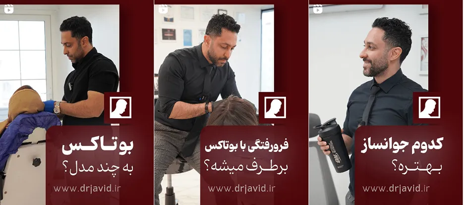 تزریق بوتاکس در هاواز توسط دکتر جاوید کاملا قابل انجام است