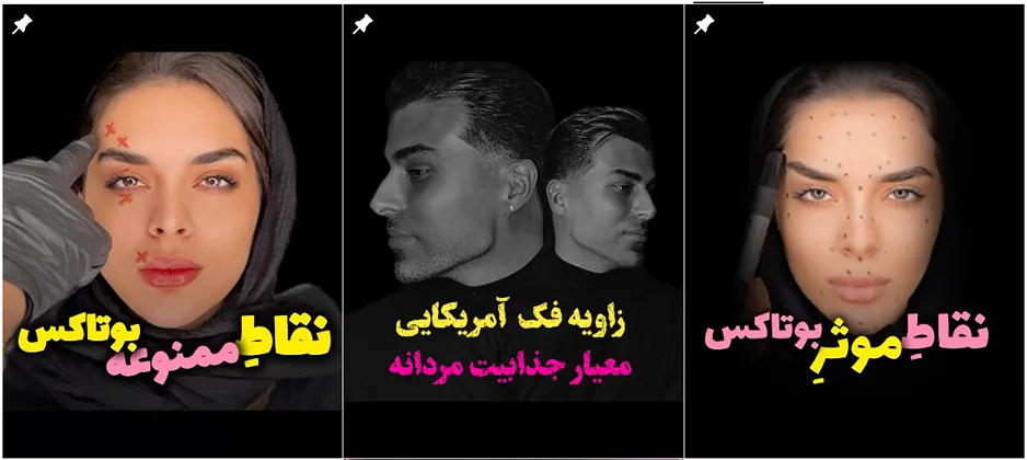 بوتاکس کرج در کلینیک دکتر حاجی علی کاملا قابل انجام است