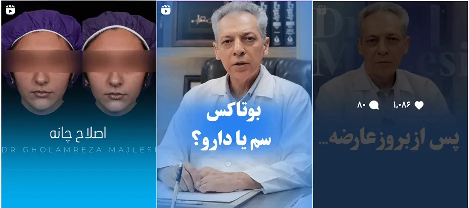 تصویر یکی از بهترین دکتر بوتاکس اصفهان را مشاهده میفرمایید.