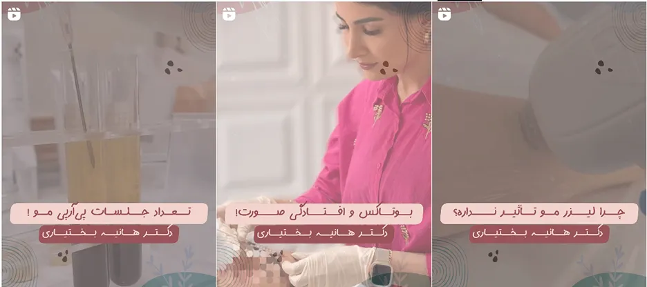 بوتاکس ایلام توسط دکتر بختیاری کاملا قابل انجام است