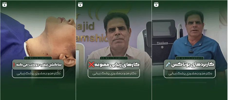 بوتاکس در ایلام توسط دکتر جمشیدی کاملا قابل انجام است