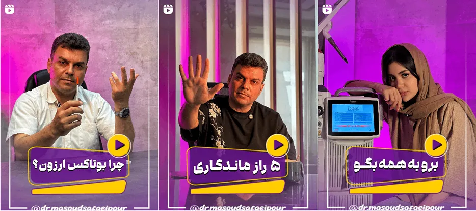 نمونه کار یکی از هبترین دکتر بوتاکس در قم را مشاهده میفرمایید