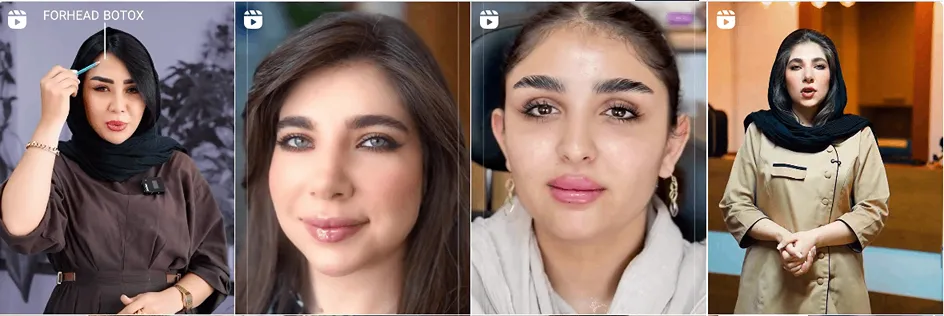 نمونه کار یکی از بهترین کلینیک زیبایی تبریز را مشاهده میفرمایید.