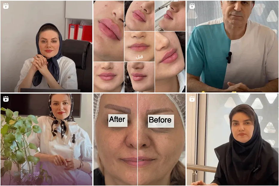نمونه کار یکی از بهترین کلینیک زیبایی تبریز را مشاهده میفرمایید