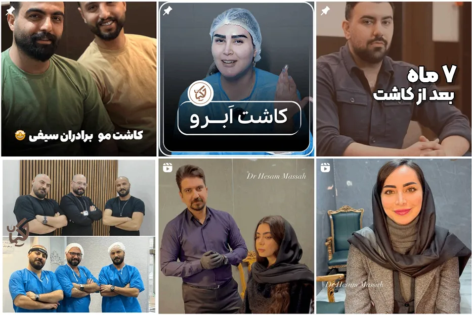 نمونه کار جکیمان یکی از بهترین کلینیک زیبایی تبریز است