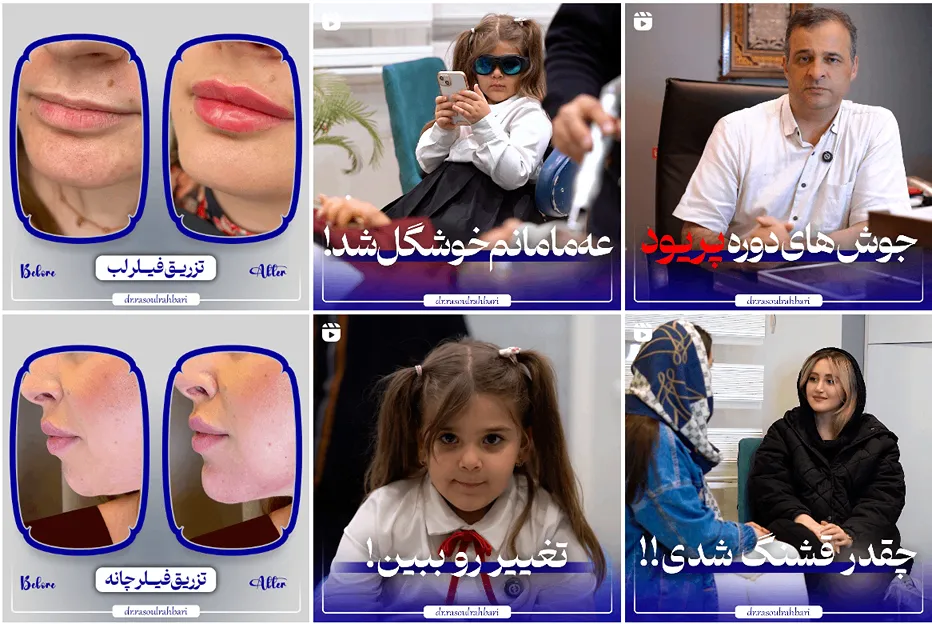 نمونه کار دکتر رهبری در کلینیک زیبایی تبریز را مشاهده میکنید.