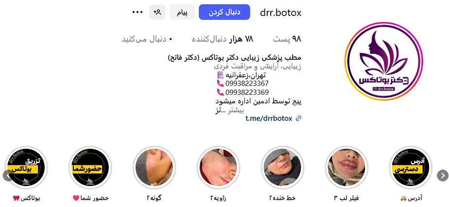 دکتر فاتح از جمله بهترین دکتر بوتاکس در تهران است