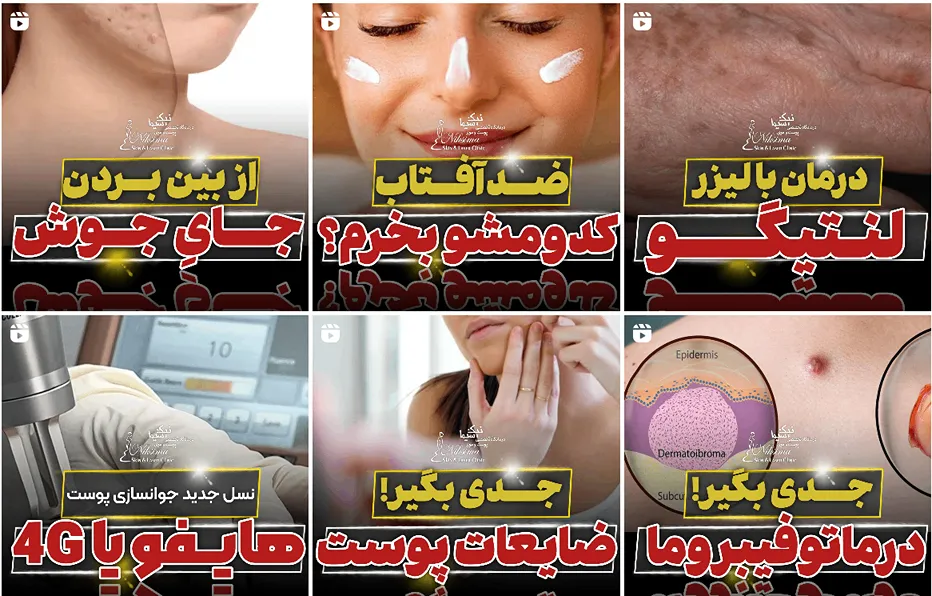 کلینیک نیک سیما از بهترین کلینیک زیبایی تبریز است