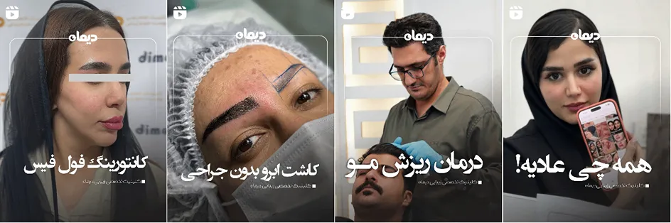 نمونه کار یکی از بهترین کلینیک زیبایی در کرمانشاه را مشاهده میفرمایید.