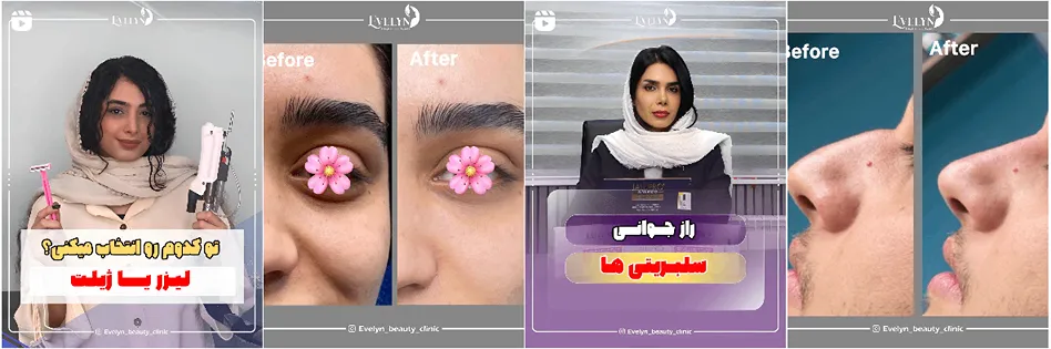 نمونه کار یکی از مدرن ترین کلینیک زیبایی رشت را مشاهده میفرمایید.