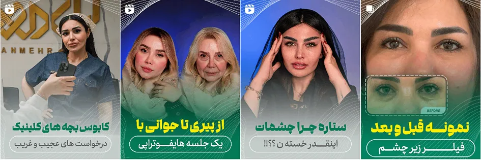 نمونه کار یکی از بهترین کلینیک زیبایی اهواز را مشاهده میفرمایید.