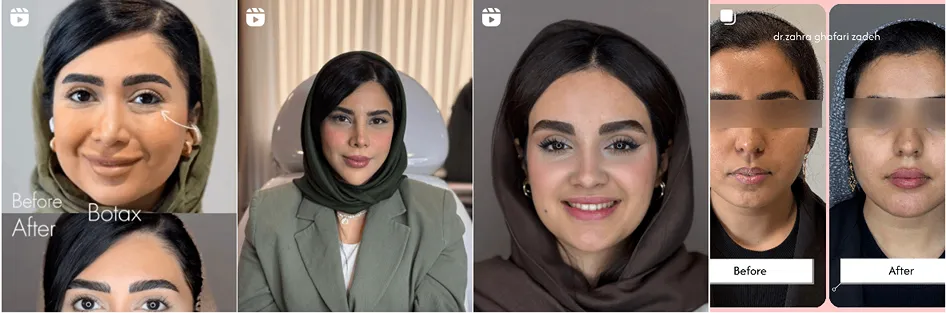 نمونه کار یکی از بهترین کلینیک زیبایی اهواز را مشاهده میفرمایید.