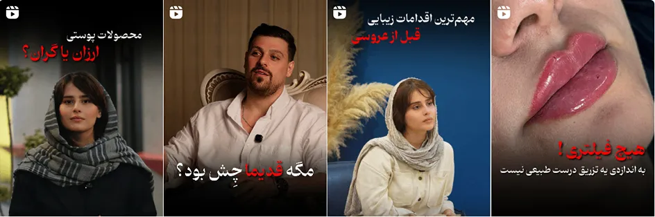 نمونه کار یکی دیگر از بهرتین کلینیک زیبای در قم را مشاهده میفرمایید.