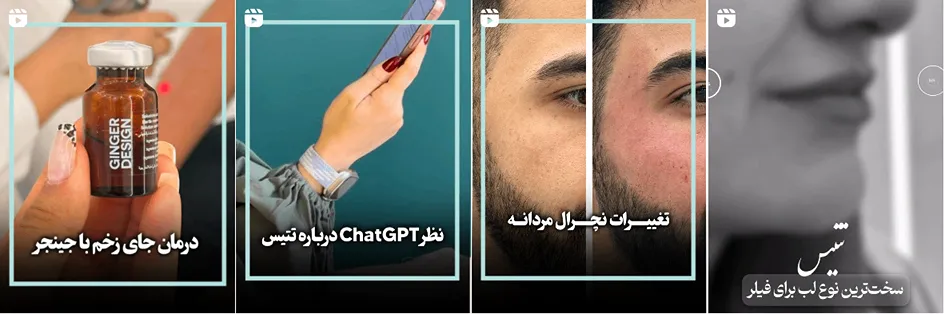 نمون کار یکی از بهترین کلینیک زیبایی در کرمانشاه را مشاهده میفرمایید.