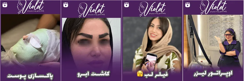 نمونه کار یکی از بهترین کلینیک زیبایی رشت را مشاهده میفرمایید.