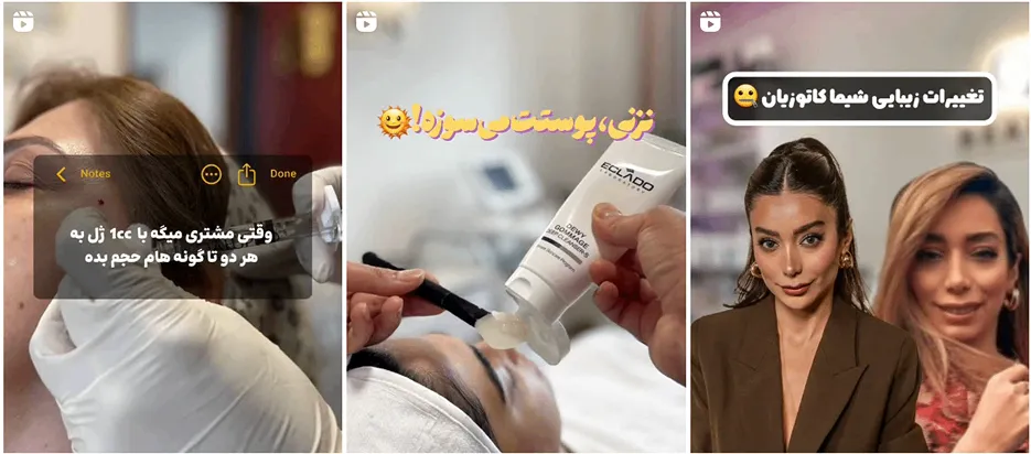 نمونه کار بهترین کلینیک زیبایی رشت را مشاهده میفرمایید.