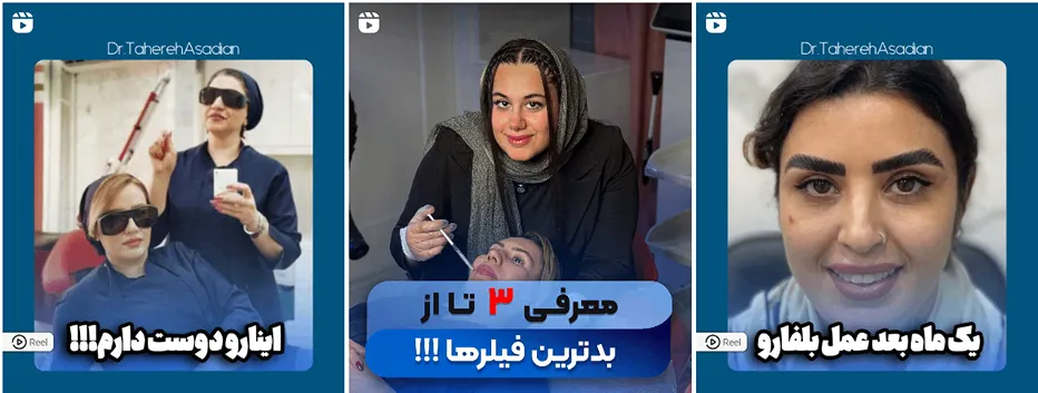 تصاویری از نمونه کار بهترین کلینیک زیبایی در اهواز را مشاهده میفرمایید.