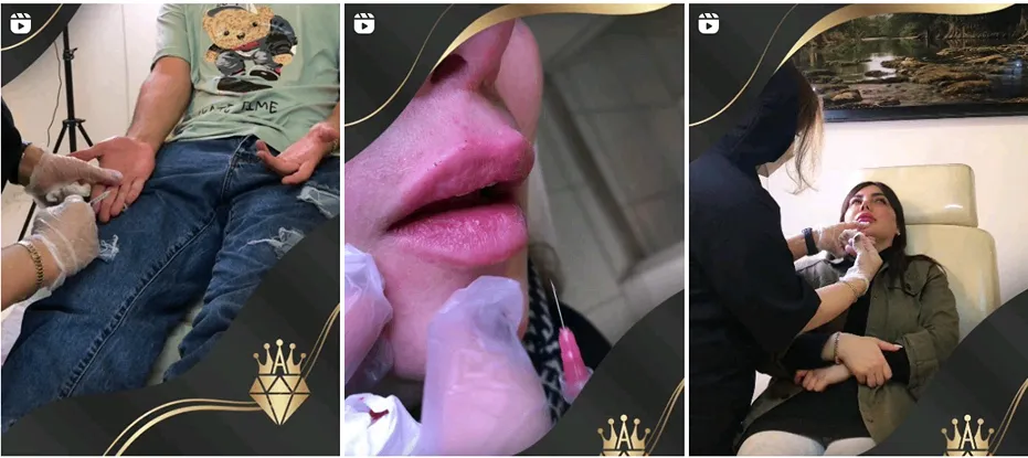 تصاویری از نمونه کار کلینیک زیبایی در رشت را مشاهده میفرمایید.