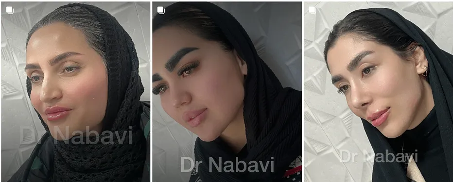 نمونه کار بهترین کلینیک زیبایی قم را مشاهده میفرمایید