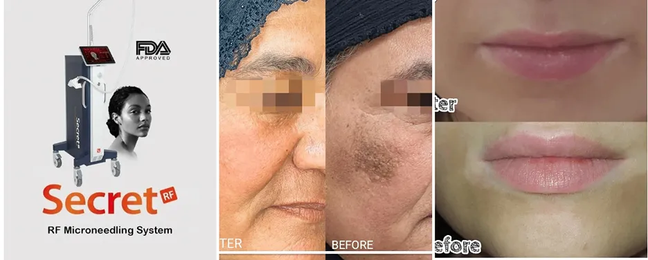 دکتر بافنده از بهترین دکترین کلینیک زیبایی اهواز است