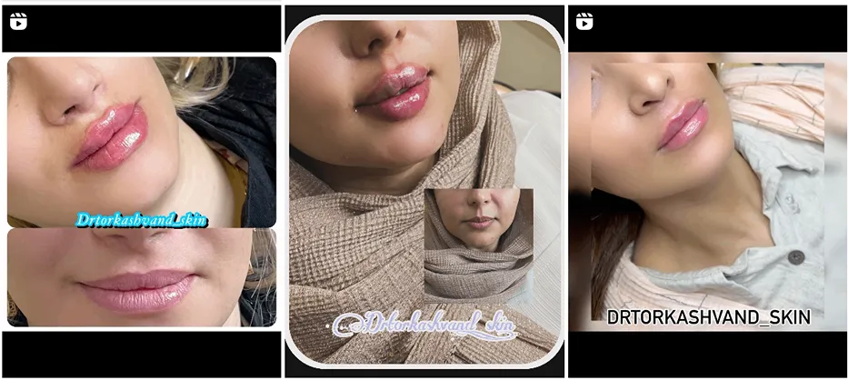 دکتر ترکاشوند از بهترین دکترین کلینیک زیبایی کرمانشاه است