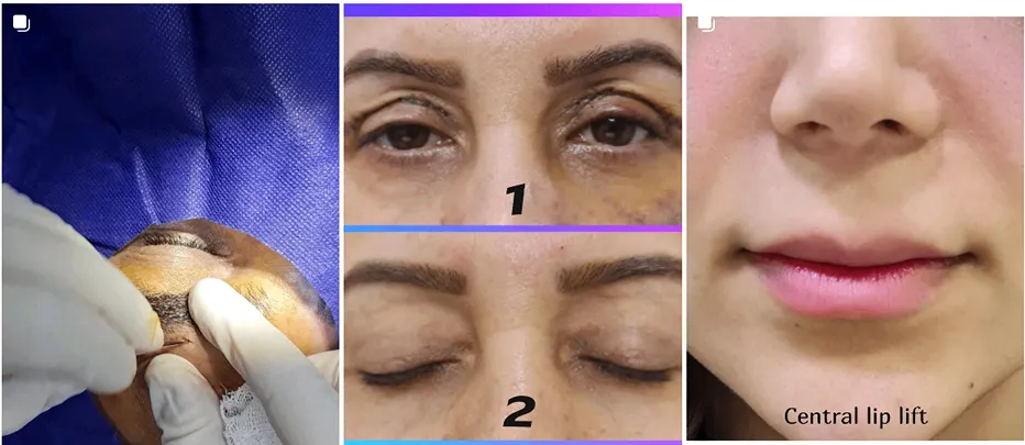 کلینیک زیبایی در اهواز دارای متخصصین کاملا مجربی هست