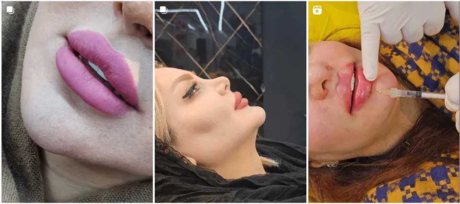 دکتر ابراهیمی یکی از بهترین دکتر کلینیک زیبایی کرمانشاه است