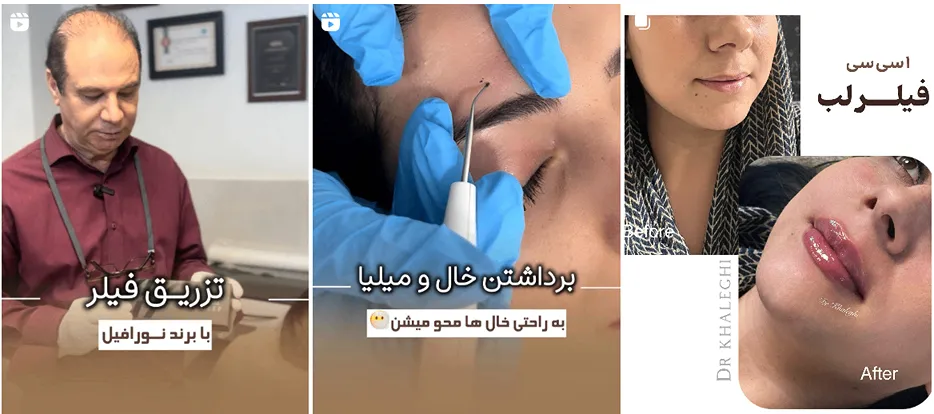 دکتر خالقی از بهترین متخصصین کلینیک زیبایی در قزوین است