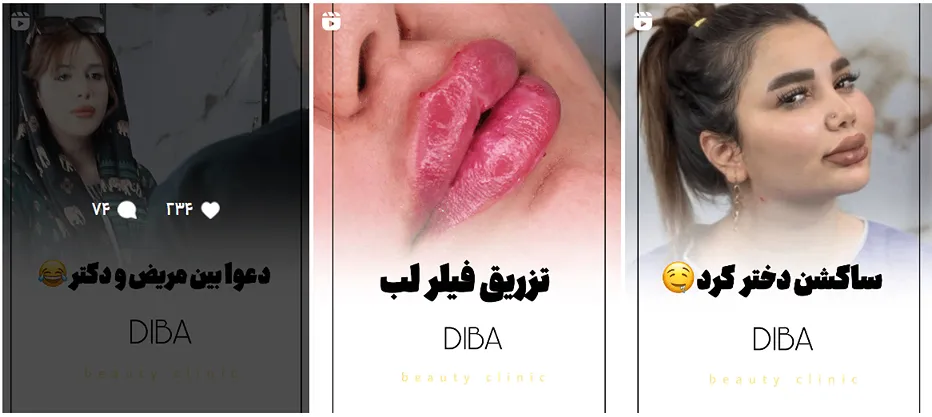 نمونه کار یکی از بهترین کلینیک زیبایی در کرمانشاه را مشاهده میفرمایید.