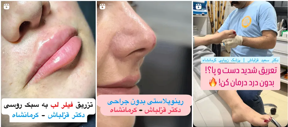 نمونه کار یکی از بهترین کلینیک زیبایی کرمانشاه را مشاهده میفرمایید.