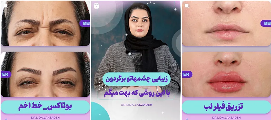 دکتر لک زاده دارای تجربه بسیار در بهترین کلینیک زیبایی در همدان است
