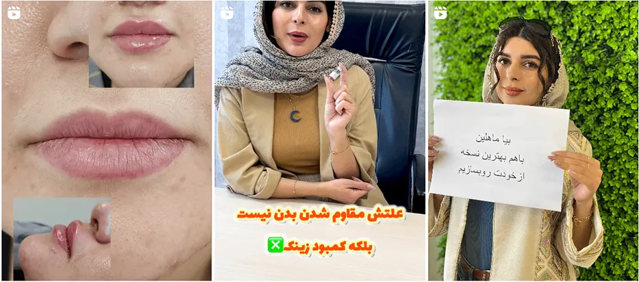 یکی از مطمئن ترین کلینیک زیبایی همدان کلینیک ماهلین است