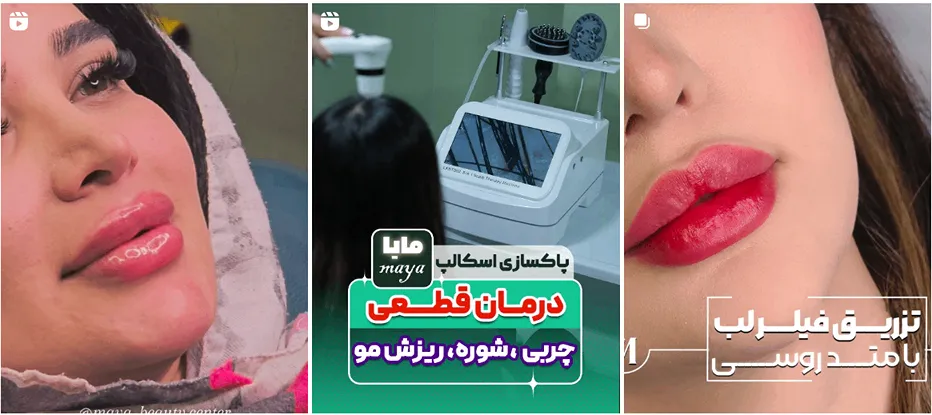 کلینیک مایا یکی از بهترین کلینیک زیبایی در همدان است