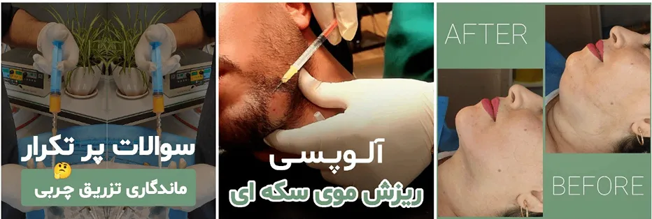 نمونه کار یکی از بهترین کلینیک زیبایی در اهواز را مشاهده میفرمایید.