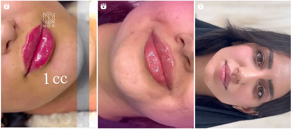 کلینیک زیبایی نور از بهترین کلینیک زیبایی کرمانشاه است