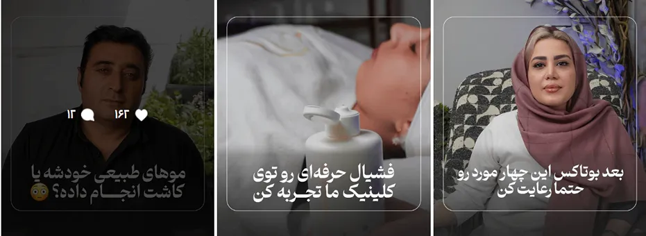 نمونه کار دکتر پورخاران از بهترین دکتر کلینیک زیبایی در قم را مشاهده میفرمایید.