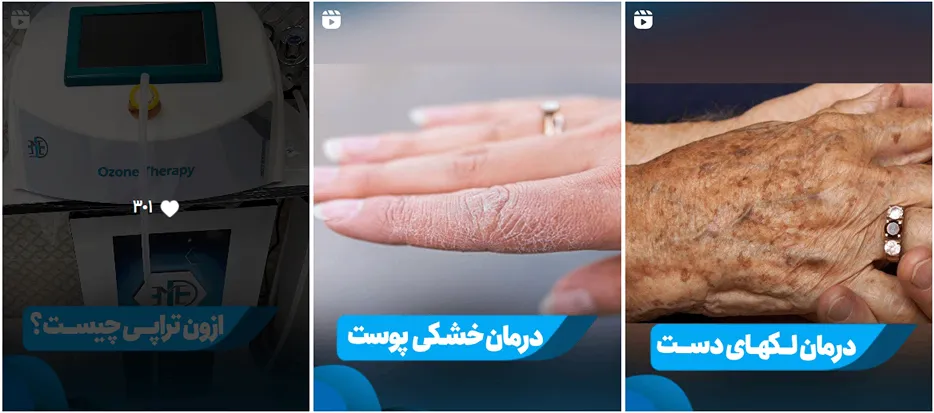 دکتر صمدی از با تجربه ترین متخصصین کلینیک زیبایی در همدان است