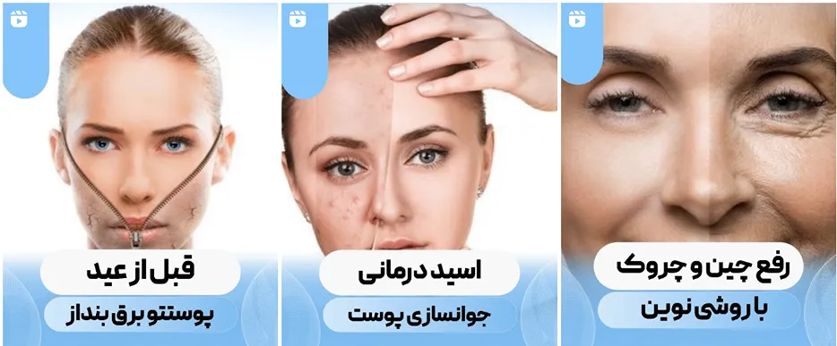 نمونه کار کلینیک زیبایی گینو بدون شک از بهترین کلینیک زیبایی اهواز است