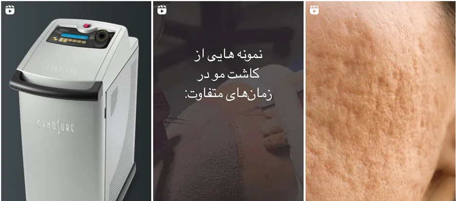 نمونه کار یکی از بهترین کلینیک زیبایی در کرمانشاه را مشاهده میفرمایید.