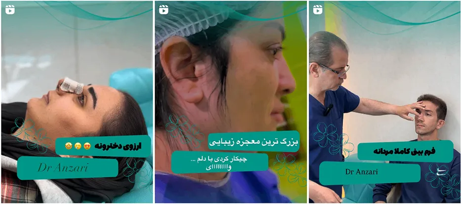 نمونه کاری از بهترین کلینیک زیبایی در اردبیل را مشاهده میفرمایید