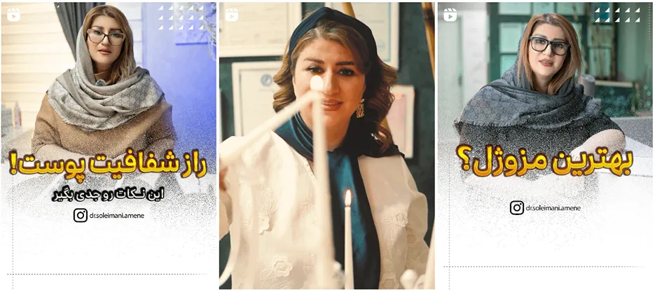 نمونه کار دکتر سلیمانی از بهترین کلینیک زیبایی اردبیل را مشاهده میفرمایید.