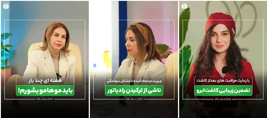 نمونه کار دکتر جلیلی فر دارنده بهترین کلینیک زیبایی در اردبیل ار مشاهده میفرمایید.