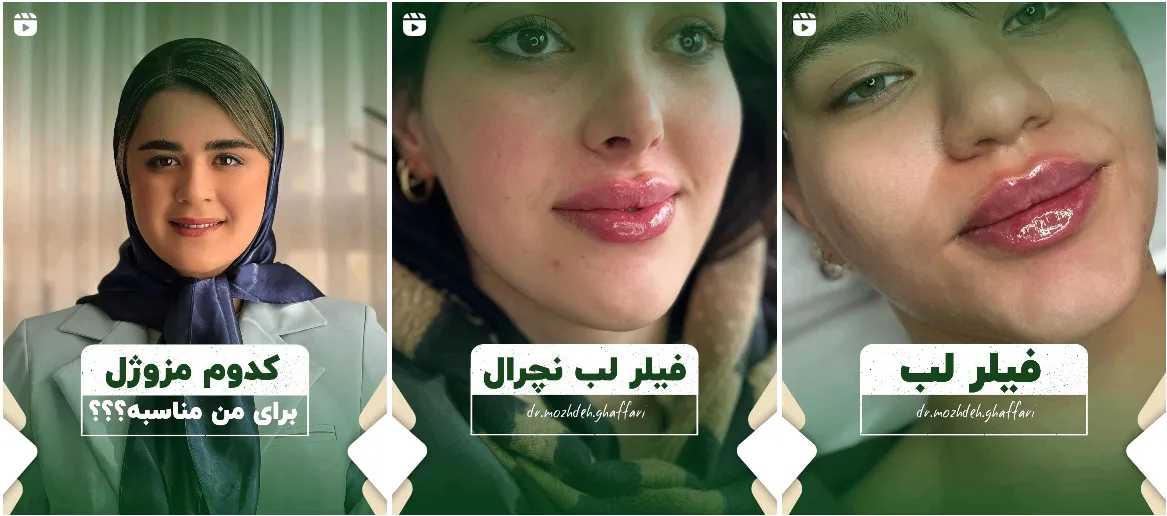 نمونه کار یکی از بهترین کلینیک زیبایی در اردبیل را مشاهده میفرمایید.