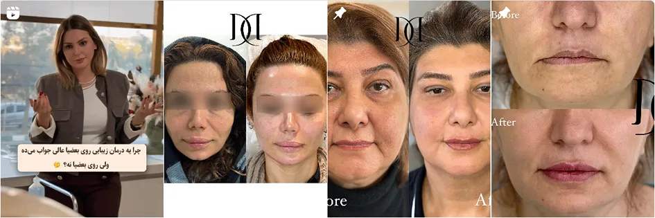 نمونه کار یکی دیگر از بهترین مراکز زیبایی در ارومیه را مشاهده میفرمایید.